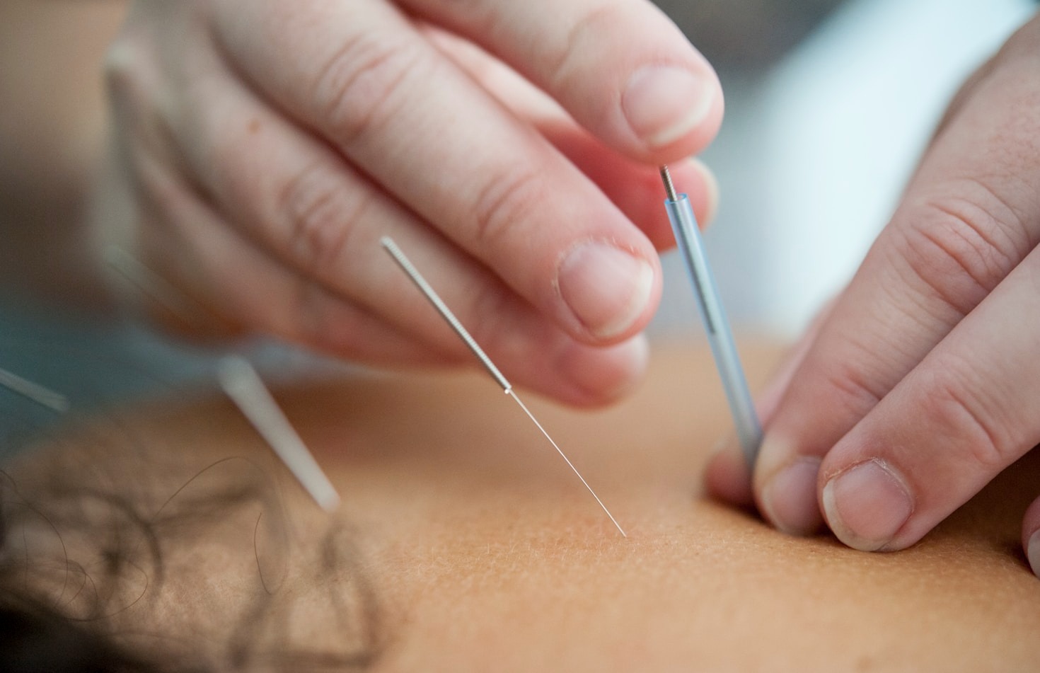 Understanding The Connection Between Diet And Inflammation