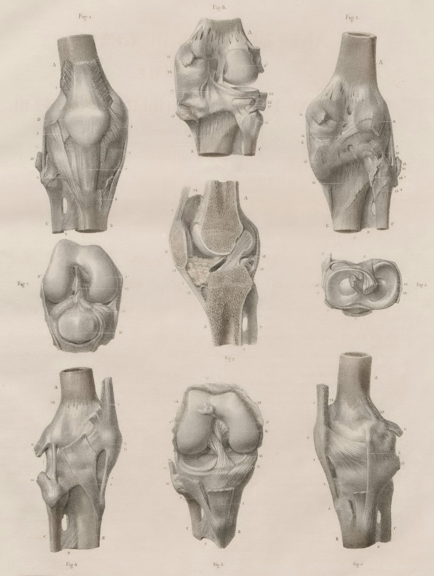 Identifying Common Triggers For Joint Stiffness